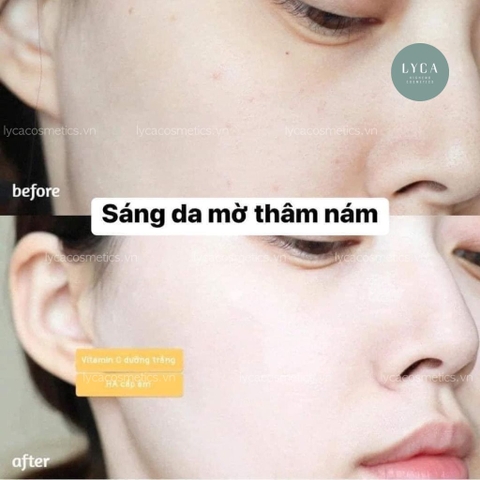 [OBAGI] Serum Obagi Tinh Chất Dưỡng Trắng Da Obagi Clinical Vitamin C + Arbutin Brightening Serum 30ml