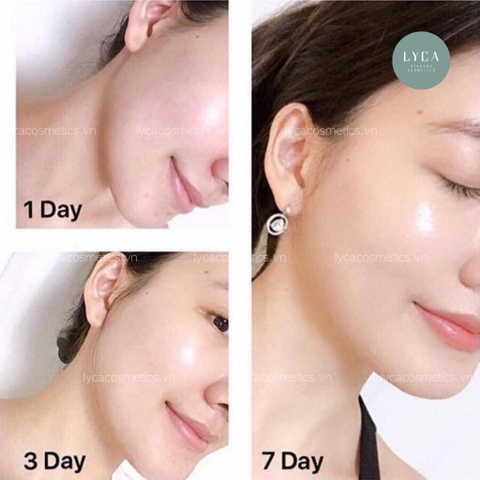 [OLAY] Set Kem Dưỡng Olay Total Effects 7 in 1 Ngày và Đêm