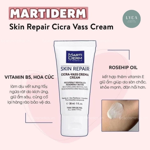 [MARTIDERM] Kem Dưỡng Tái Tạo & Phục Hồi Da Nhạy Cảm - MartiDerm Skin Repair Cicra Vass Cream 30ml