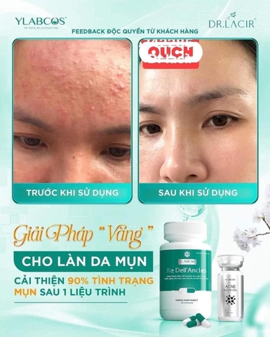 Viên uống mụn Re Dell’Ancles. MP