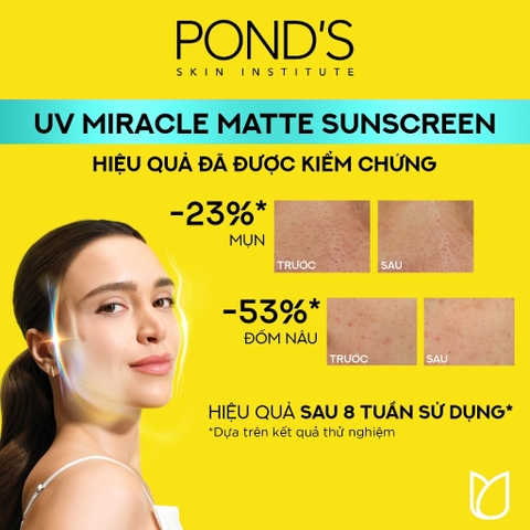 Kem chống nắng phổ rộng Pond's UV Miracle SPF 50+ PA++++ Tuýp 50G