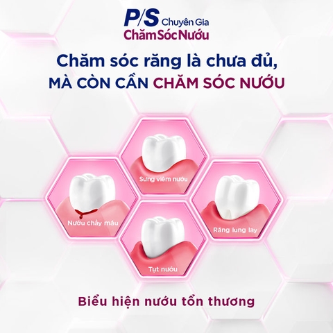 Kem Đánh Răng PS Gum Expert Chuyên Gia - Tuýp 100G