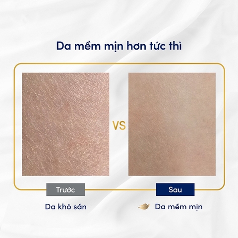 Sữa Tắm Serum Dove - Chai 500G