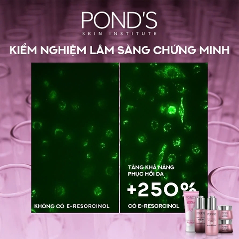 Serum Dưỡng Sáng Da Đa Tầng Pond Bright Miracle Ngày & Đêm Mờ Thâm Sạm Với 50X Niasorcinol - Lọ 30G (Hồng)