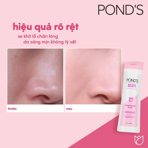 Nước Hoa Hồng POND White Beauty Sáng Da Cân Bằng pH - Chai 150ML