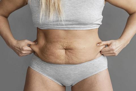 15 cách giảm mỡ bụng sau sinh an toàn cho cả mẹ và con