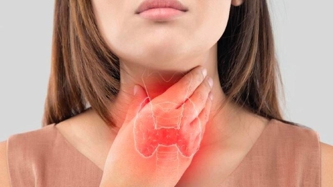 Người bị bướu cổ kiêng ăn gì để hạn chế bệnh trở nặng