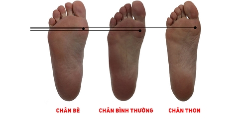 Hướng dẫn cách phân biệt chân bè chân thon khi chọn giày đá bóng