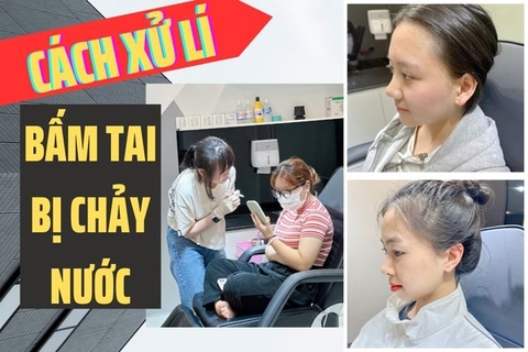 Bấm khuyên tai bị chảy nước: Đúng và sai khi xử lí tại nhà