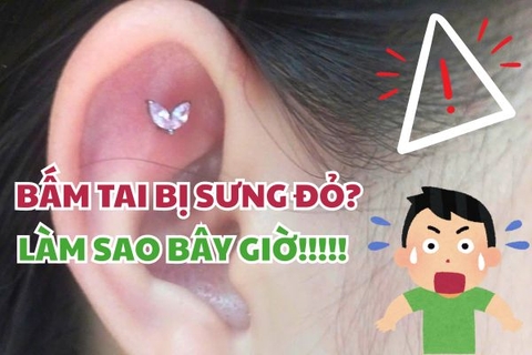 Bấm lỗ tai bị sưng đỏ phải làm sao? Phân biệt & Xử lý tại nhà an toàn