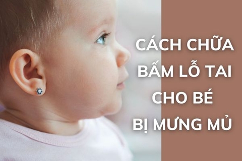 Bấm lỗ tai cho bé bị mưng mủ phải làm sao?