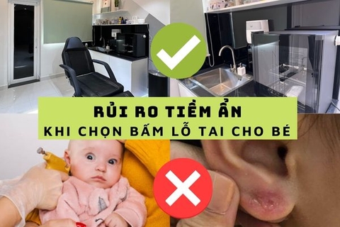 Bấm lỗ tai cho bé ở tiệm vàng đầy rủi ro & Kỹ thuật mới khắc phục tất cả