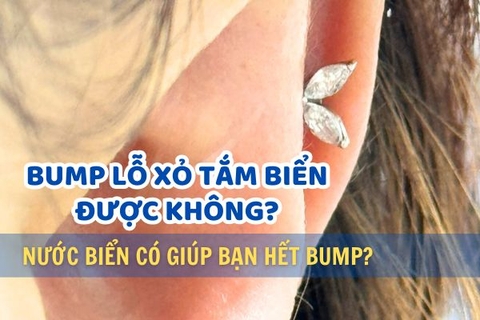 Bump lỗ xỏ tắm biển được không? Nước biển giúp bạn hết bump?
