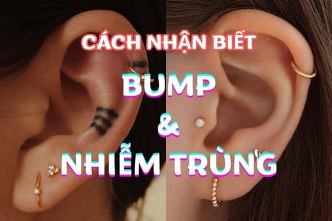 Cách nhận biết bump và nhiễm trùng, mối đe dọa của nhiều bạn