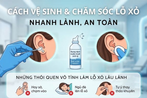 Cách vệ sinh & chăm sóc lỗ xỏ khuyên nhanh lành