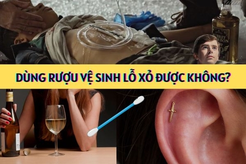 Dùng rượu vệ sinh lỗ xỏ khuyên được không? Bật mí sự thật
