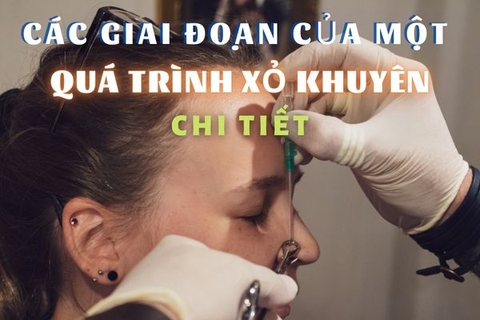 Giai đoạn xỏ khuyên: Mô tả từ A-Z quá trình xỏ đến khi lỗ xỏ lành
