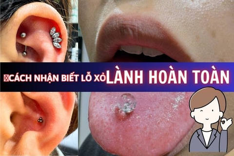 Làm sao để biết lỗ xỏ khuyên đã lành hoàn toàn?