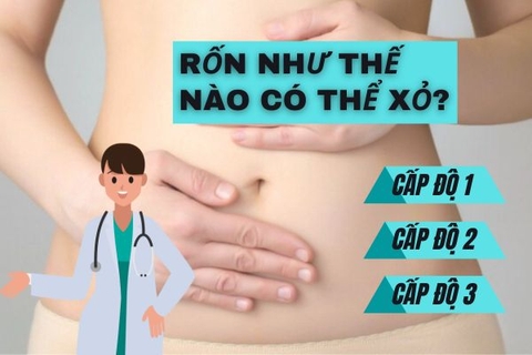 Lỗ rốn như thế nào thì nên xỏ và không nên xỏ?