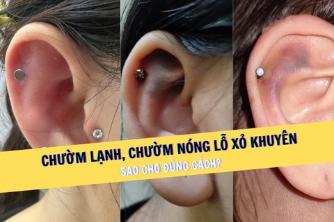 Lỗ xỏ khuyên khi nào chườm lạnh và khi nào chườm nóng?