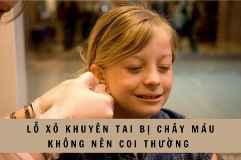 Vì sao lỗ xỏ khuyên tai bị chảy máu? 5 bước xử lí tại nhà an toàn