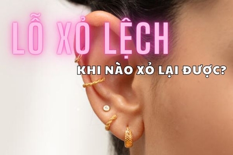 Lỗ xỏ khuyên tai bị lệch khi nào xỏ lại được?