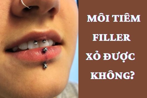 Môi tiêm filler có xỏ khuyên miệng được không? TinyBox chia sẻ