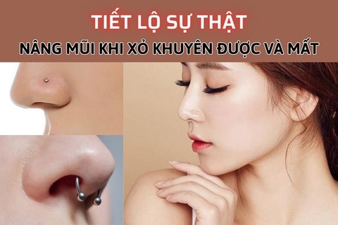 Nâng mũi có xỏ khuyên mũi được không? Thợ xỏ bật mí sự thật