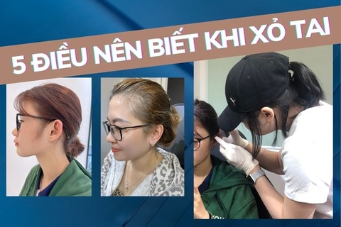 Những điều cần biết khi xỏ khuyên tai - 5 lưu ý cực quan trọng