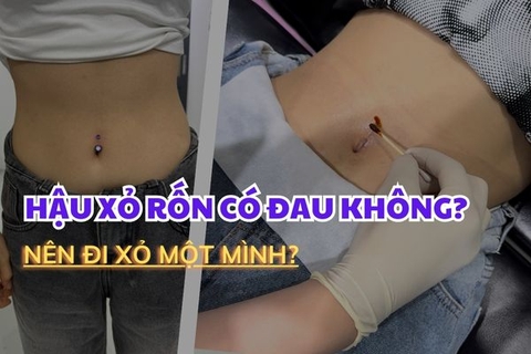 Sau khi xỏ rốn có đau không? Nên đi xỏ một mình không?