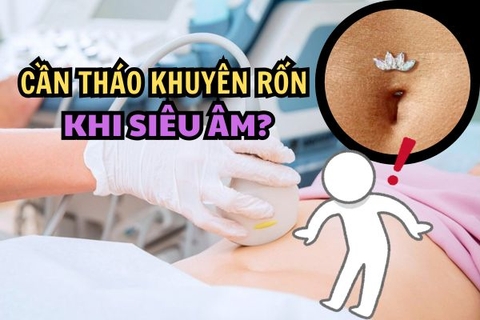 Siêu âm bụng cần chuẩn bị gì? Có cần tháo khuyên rốn không?
