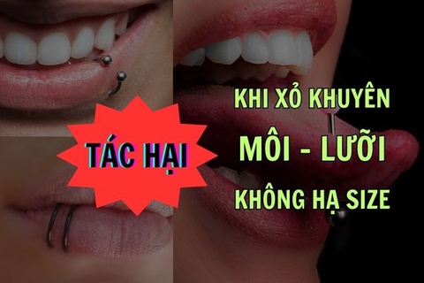 Tác hại xỏ khuyên môi và lưỡi khi không hạ size - Cách xử lí
