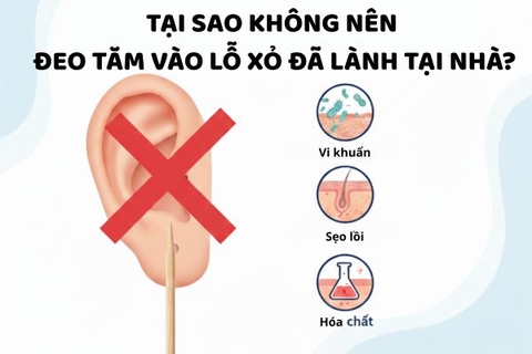 Tại sao không nên đeo tăm vào lỗ xỏ đã lành tại nhà?