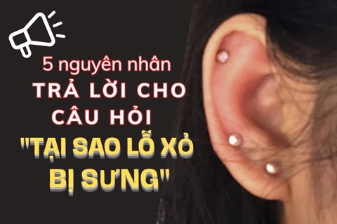 Tại sao lỗ xỏ bị sưng? 5 nguyên nhân và cách xử lý an toàn