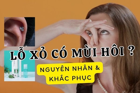 Tại sao lỗ xỏ có mùi hôi? Cách khắc phục hiệu quả