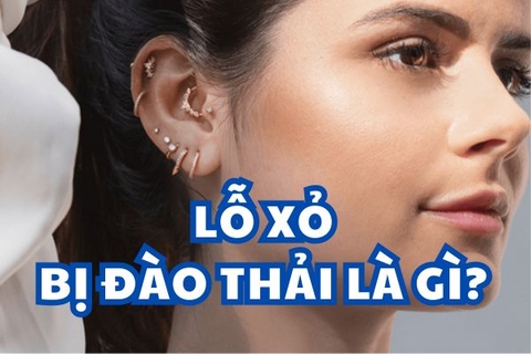 Tại sao lỗ xỏ khuyên bị đào thải và cách khắc phục