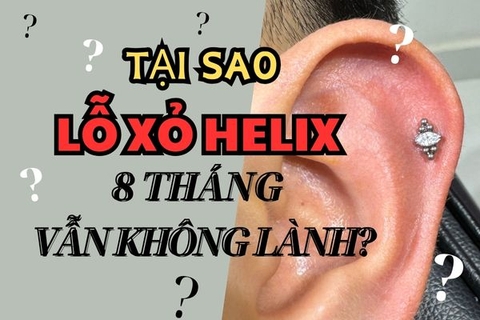 Tại sao lỗ xỏ khuyên Helix 8 tháng vẫn chưa lành?