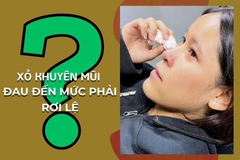 Tại sao xỏ khuyên mũi bị chảy nước mắt?