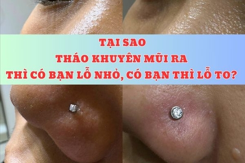 Tại sao sau khi tháo khuyên mũi bạn có lỗ xỏ nhỏ xíu bạn lỗ to?