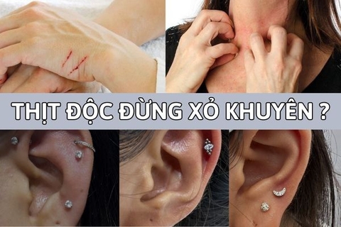 Thịt độc có nên xỏ khuyên? Bật mí sự thật mà ai cũng nhầm lẫn