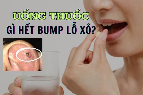 Uống thuốc gì để hết bump lỗ xỏ?