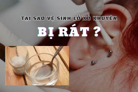 Vệ sinh lỗ xỏ khuyên bị rát: Nguyên nhân & cách xử lí