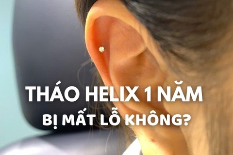 Xỏ Helix 1 năm tháo ra có bị mất lỗ không?