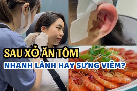 Xỏ khuyên ăn tôm được không? Lỗ xỏ nhanh lành hay sưng viêm?