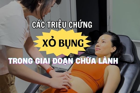 Xỏ khuyên bụng: Các giai đoạn chữa lành diễn ra như thế nào?