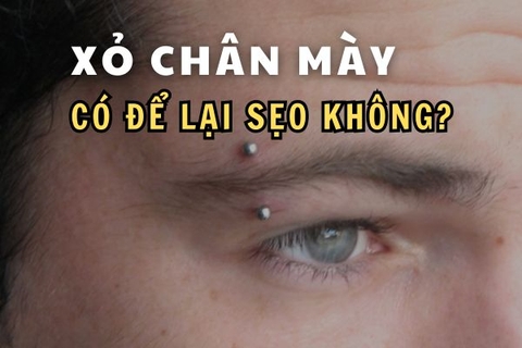 Xỏ khuyên chân mày có để lại sẹo không?