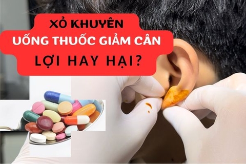 Xỏ khuyên có được uống thuốc giảm cân không?