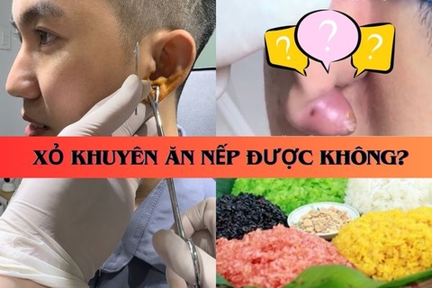 Xỏ khuyên kiêng đồ nếp bao lâu? Nếu lỡ ăn có sao không?