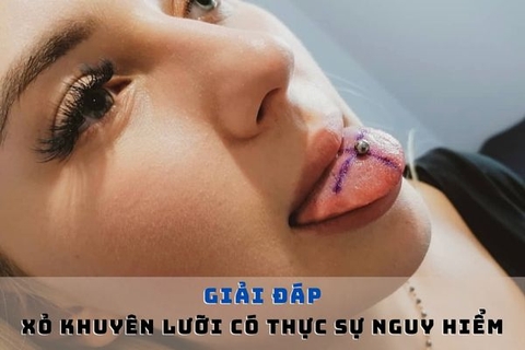 Xỏ khuyên lưỡi có nguy hiểm không? Và các câu hỏi thường gặp