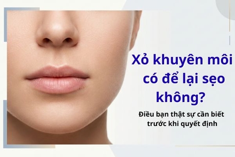 Xỏ khuyên môi có để lại sẹo không? Điều bạn thật sự cần biết trước khi quyết định